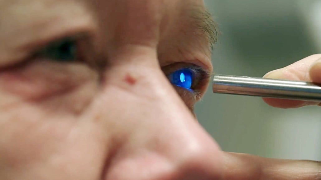 New Cataract diagnosis with Ocean spectrometer